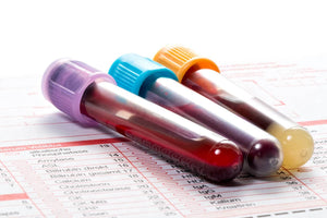 Testosterone (Blood Test) Total, Free and SHBG